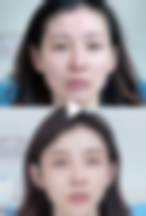 陆阳医生做手术价格