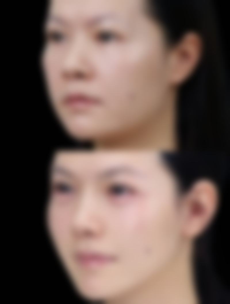 大腿吸脂能擦身体乳吗之正确使用方法