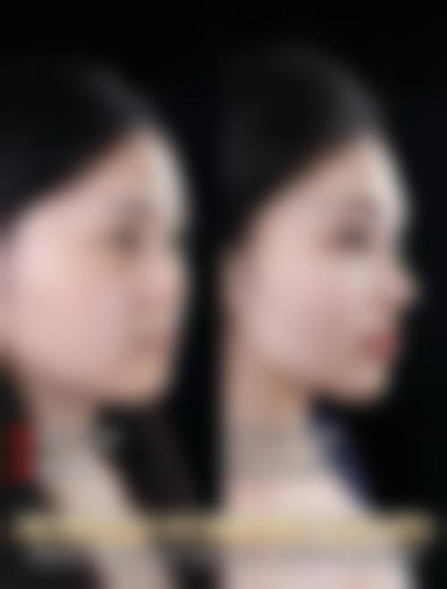 兰州美杜莎整形医院怎么样，口碑评价如何？