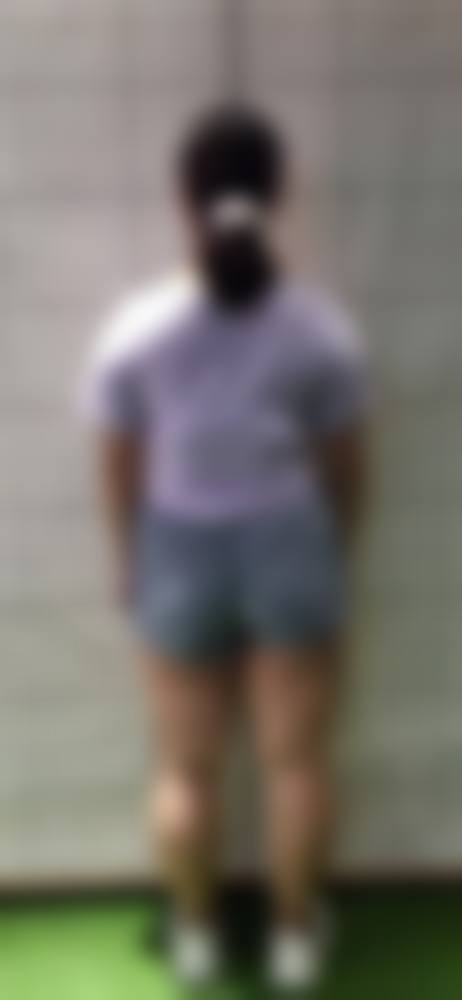 周秀峰医生简介——项目优势与特色技术