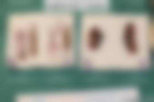 广州邦里医疗美容医院口碑好不好?附真实患者口碑评价