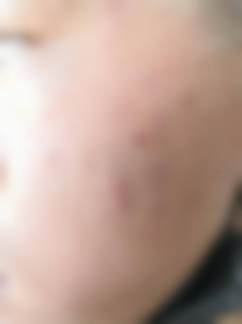 汤炳南医生简介之怎么挂号