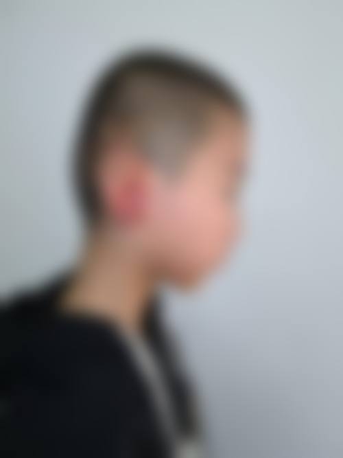 周秀峰医生简介——顾客实例图片展示