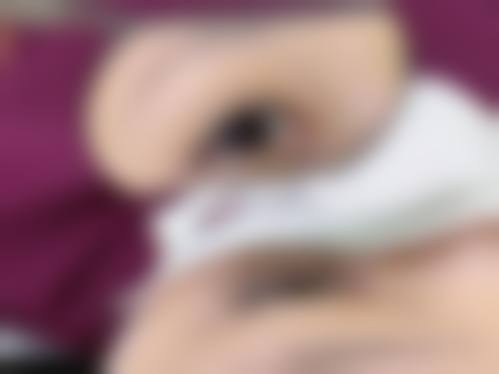 七、昆明芊丝整形医院真实患者口碑评价:实例见证良好口碑