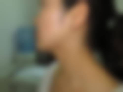 南通英莎医疗美容门诊部李辉技术怎么样——如皋星秘医疗美容门诊部