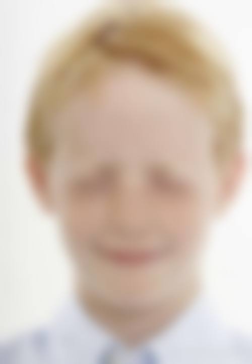 武汉微幕医疗整形美容门诊部顾客实例怎么样