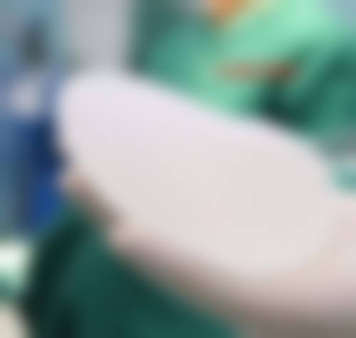 武汉微幕医疗整形美容门诊部特色项目怎么样