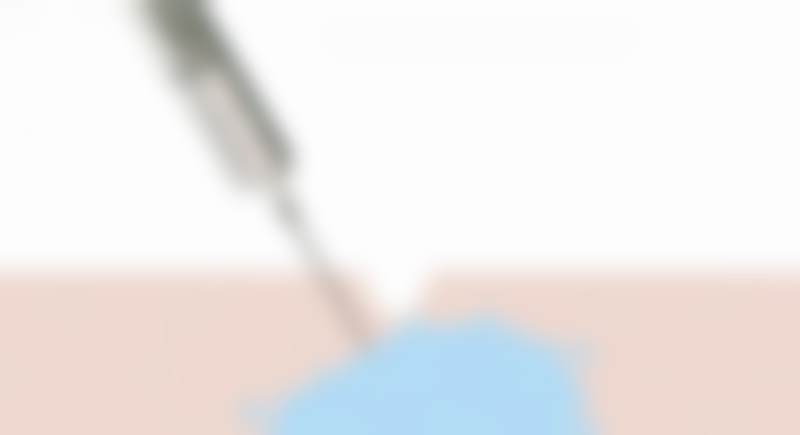 广州高尚医学美容中 心方锦平全程无忧美丽体验实例成效：一站式服务的贴心关怀