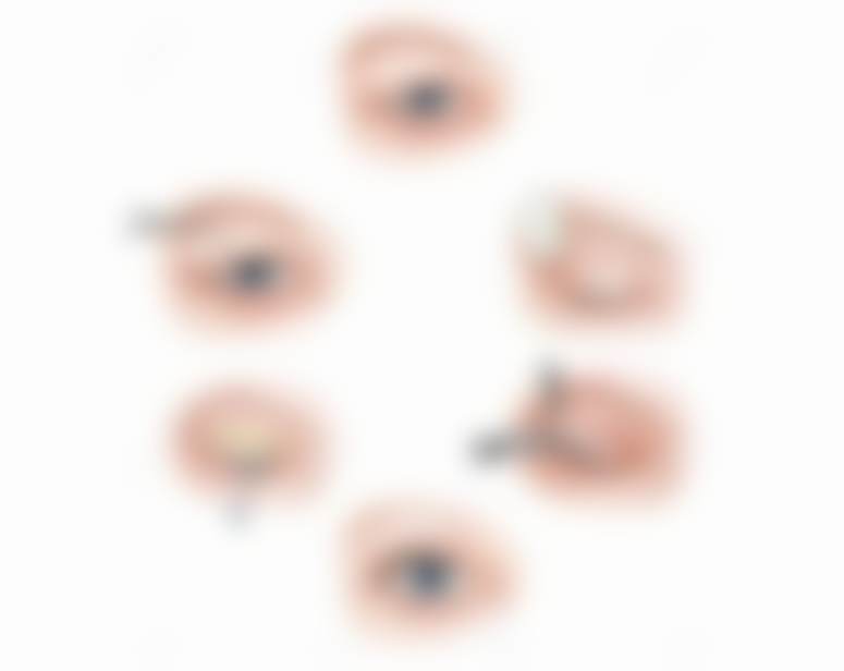 广东省医美更好的医院奥美定取出:9770元拯救你的健康