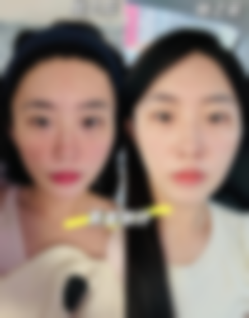 金允熙医生怎么挂号