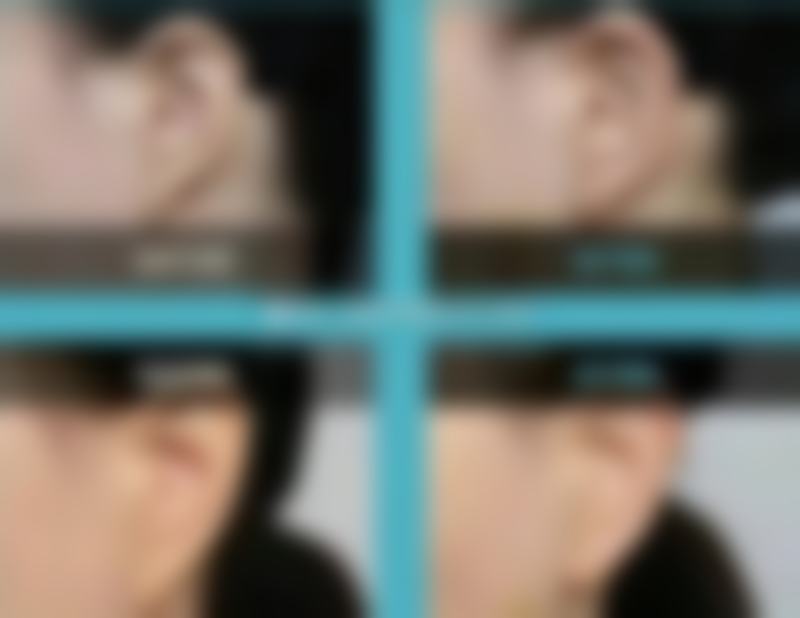 北京嘉韵医疗美容诊所价格表