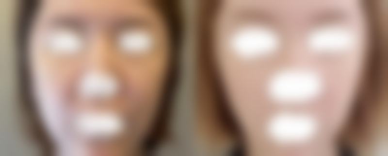 南通英莎医疗美容门诊部李辉技术怎么样——南通沈美医疗美容诊所