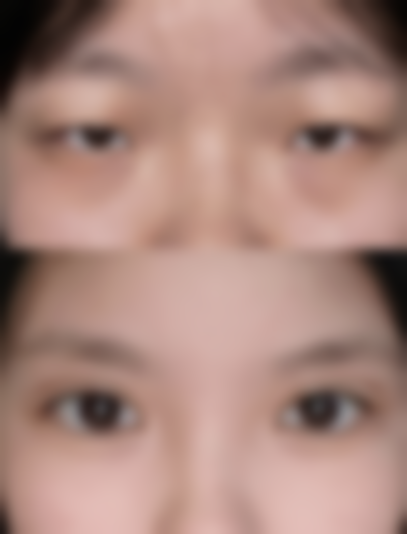 宝鸡爱容妍整形医疗美容门诊部顾客实例