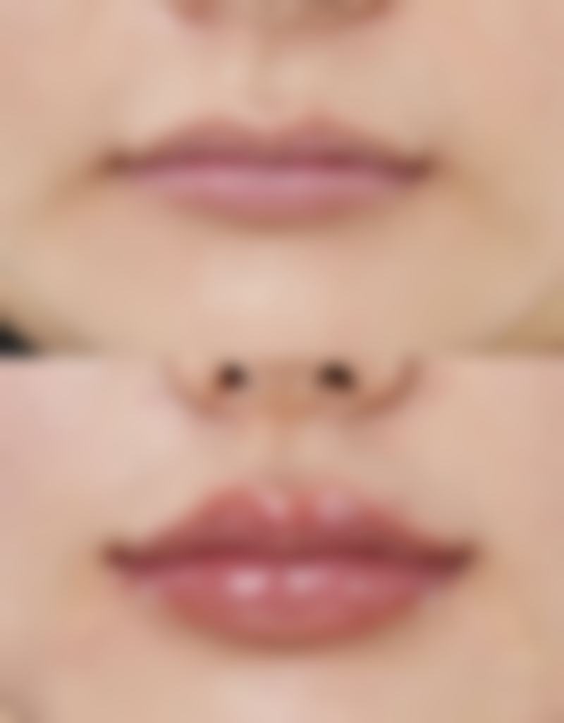 艾条与其他方法去除眼袋，谁更胜一筹