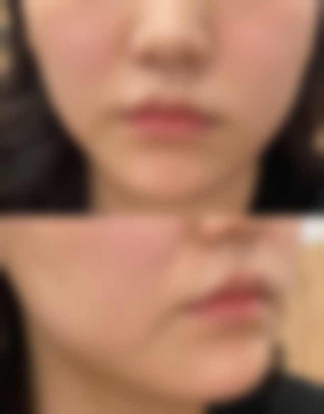 新疆安婕丽诗医疗美容整形门诊部顾客实例