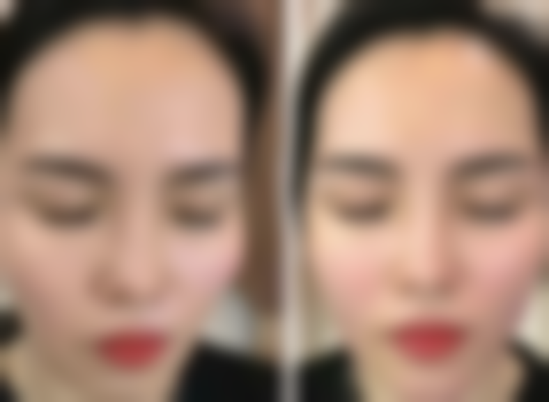 患者必读:日常护理与复发预防助力修复