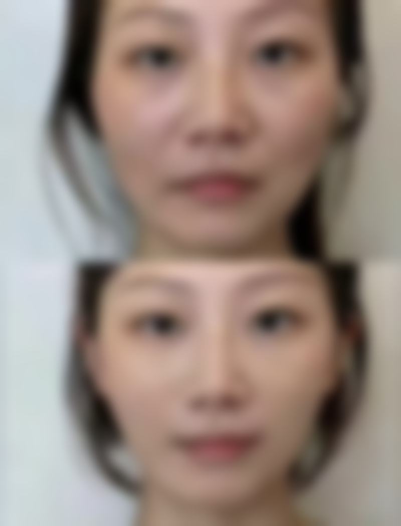 给正在修复期的你一些小鼓励