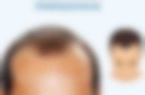 爱贝芙隆鼻成效关键条件之医院医生选择