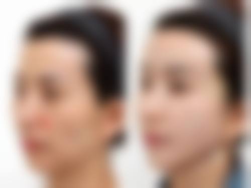 朝阳康韵医疗整形美容诊所怎么挂号，地址在哪儿