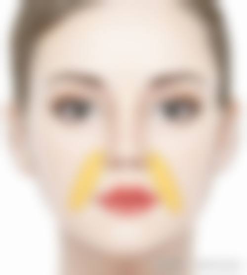 早上起来眼睛浮肿眼袋大与年龄增长有何关系