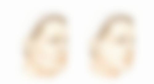 日常如何预防早上起来眼睛浮肿眼袋大