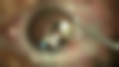 姚活锋医生项目优势