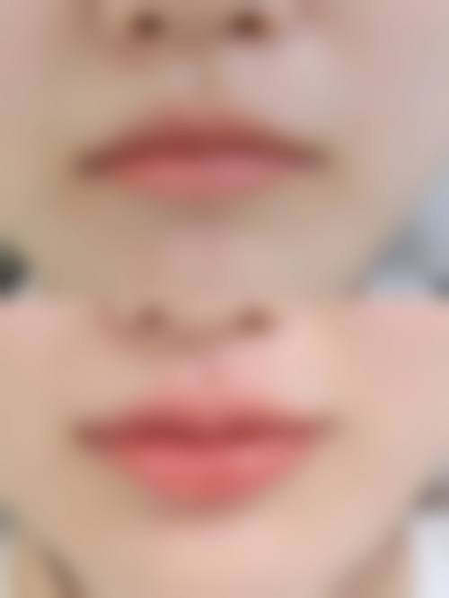 西安玛莲伦娜整形医院口碑好不好？附真实患者口碑评价