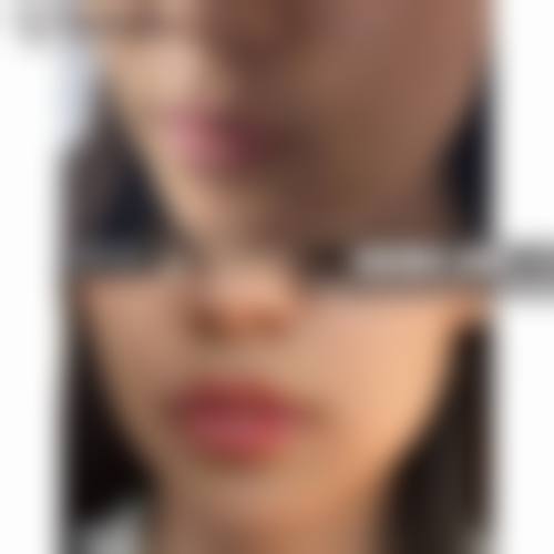 南京欧华整形医疗美容诊所更擅长什么