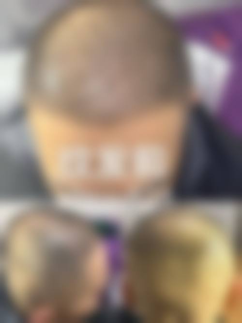 杭州舒睿妍整形医院口碑评价