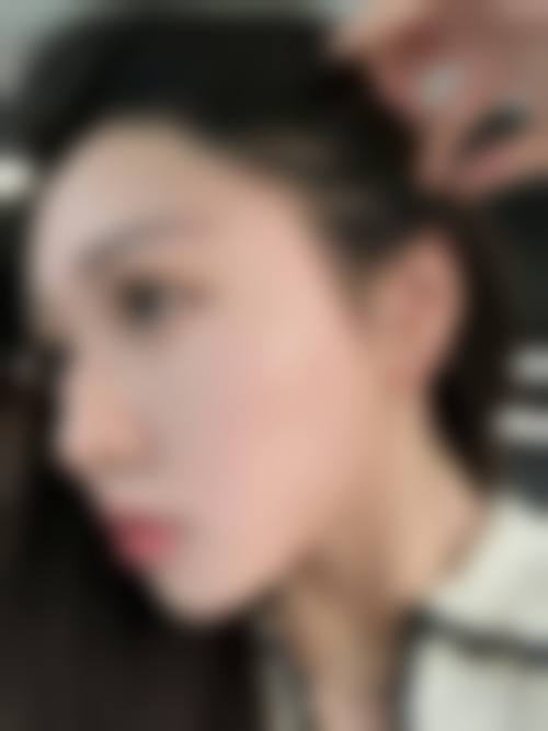 德维芳医生顾客实例图片