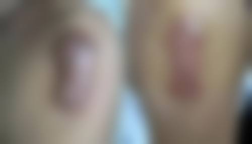 吉安瑞诺整形医院怎么样之真实患者口碑评价