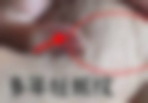 吉安瑞诺整形医院怎么样之价格表