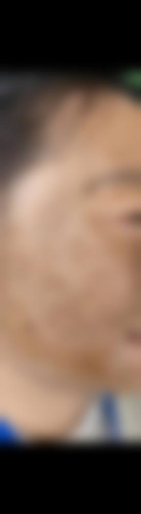 广州合景专科门诊部皮肤美容科顾客实例