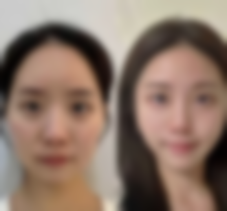 西安玛莲伦娜整形医院价格表