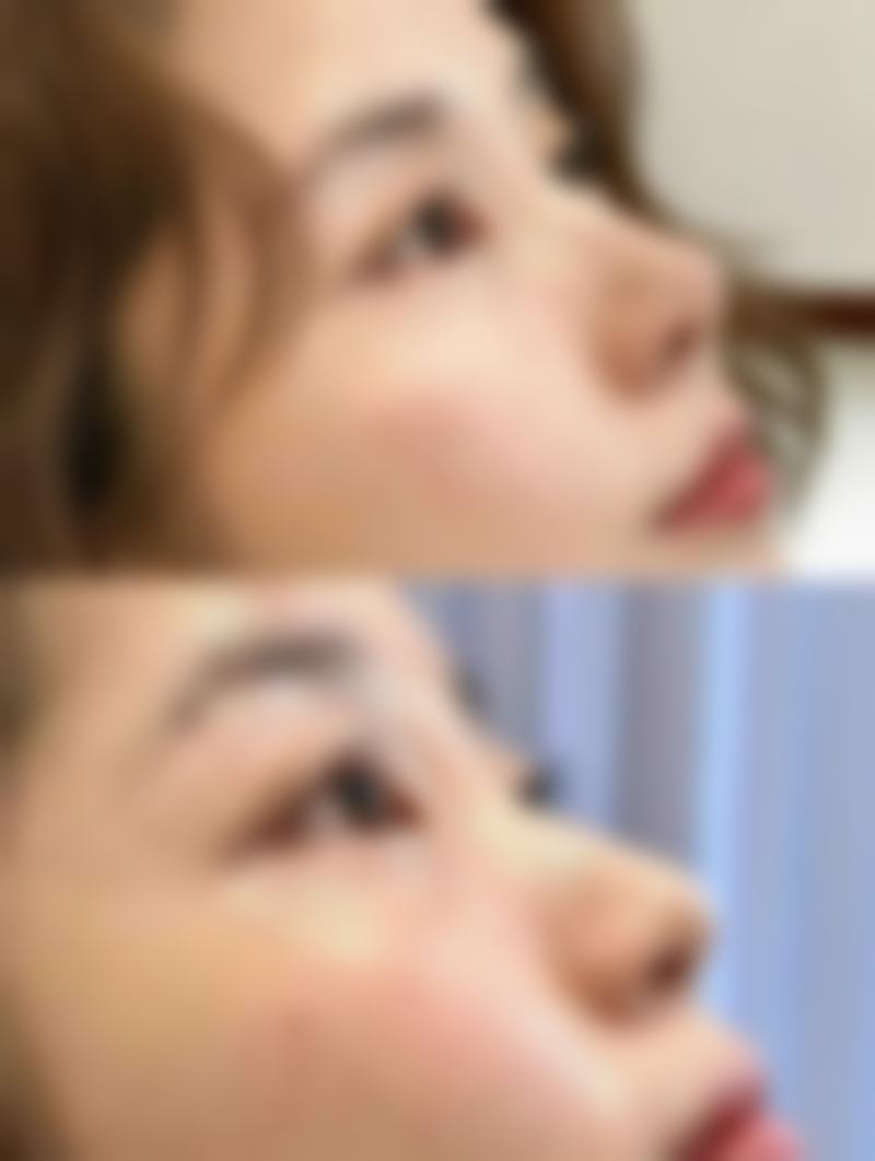 早上起来眼睛浮肿眼袋大与睡眠不足有什么关联