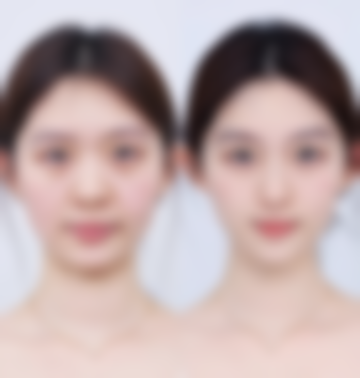 南阳维多利亚整形美容医院口碑好不好？附真实患者口碑评价