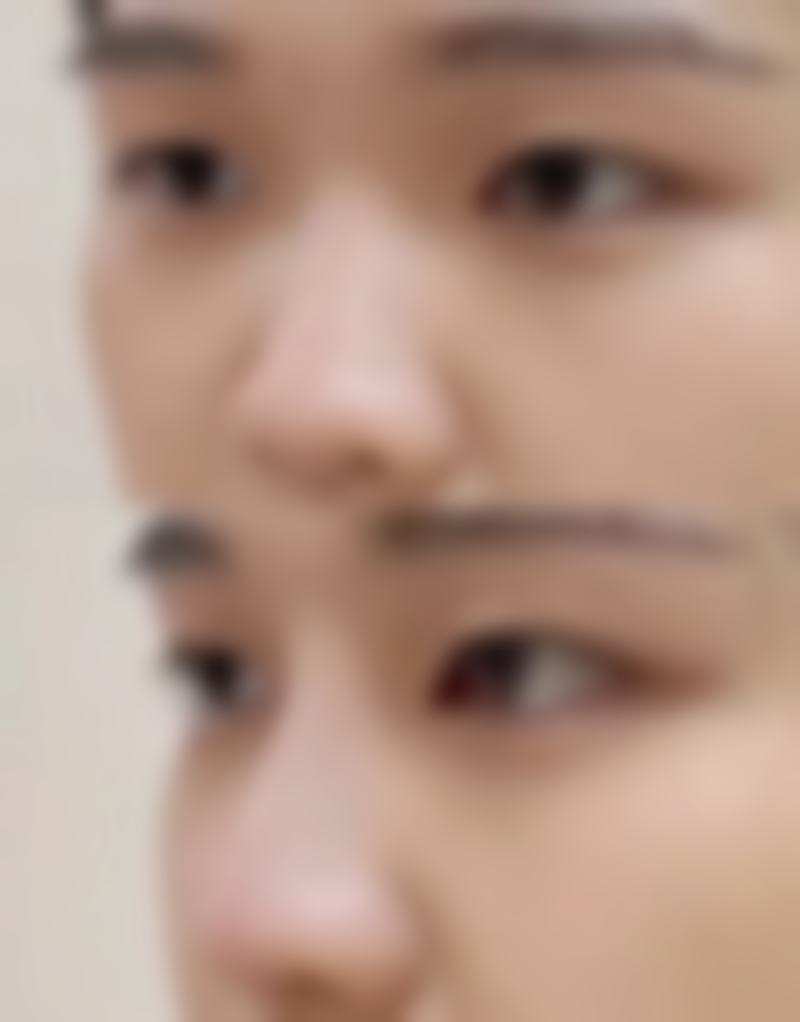 三、三亚小美微甄整形医院怎么样，口碑评价如何？