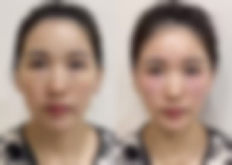 杭州舒睿妍整形医院真实患者口碑评价