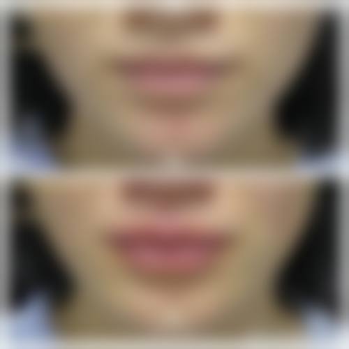 开福区美研医疗美容门诊部更擅长什么