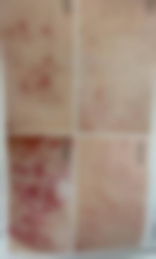 杭州贻美医疗美容门诊部特色项目有哪些