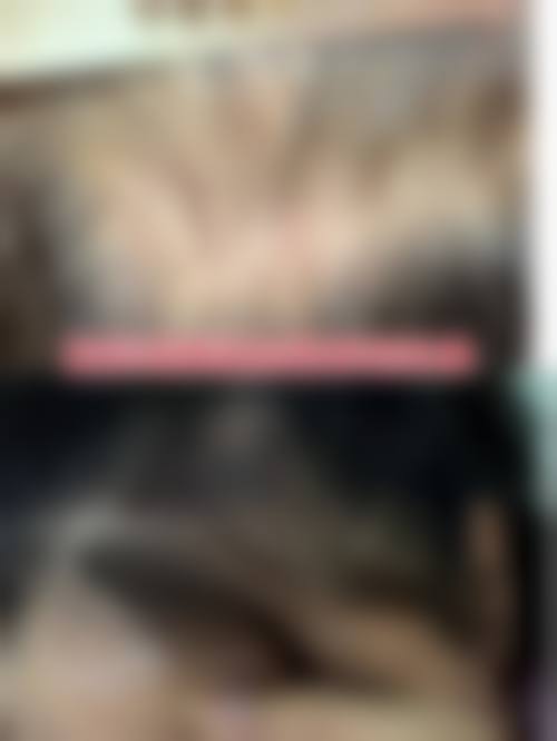 广州美恩整形医院项目特色：植发与高难度手术优势明显