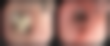 烟台新颜整形医院真实患者口碑评价