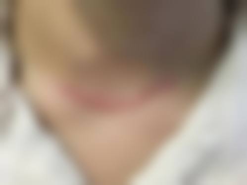 李文锋医生简介口碑如何