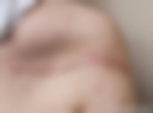 李文锋医生简介怎么挂号