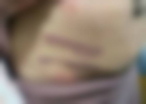 五、南宁市第一人民医院整形美容外科医生简介