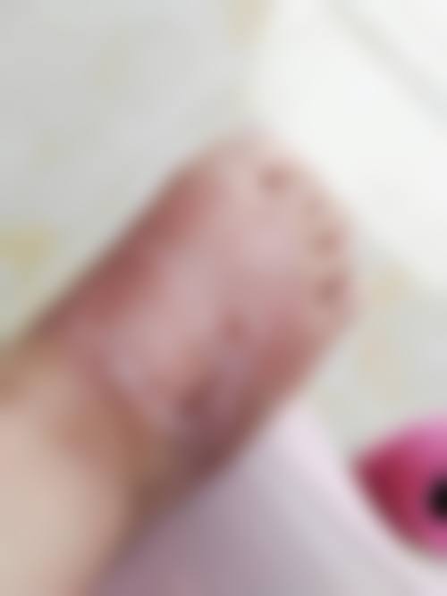 李文锋医生简介做手术价格