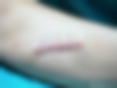 北京致漾医疗美容诊所怎么样，价格表