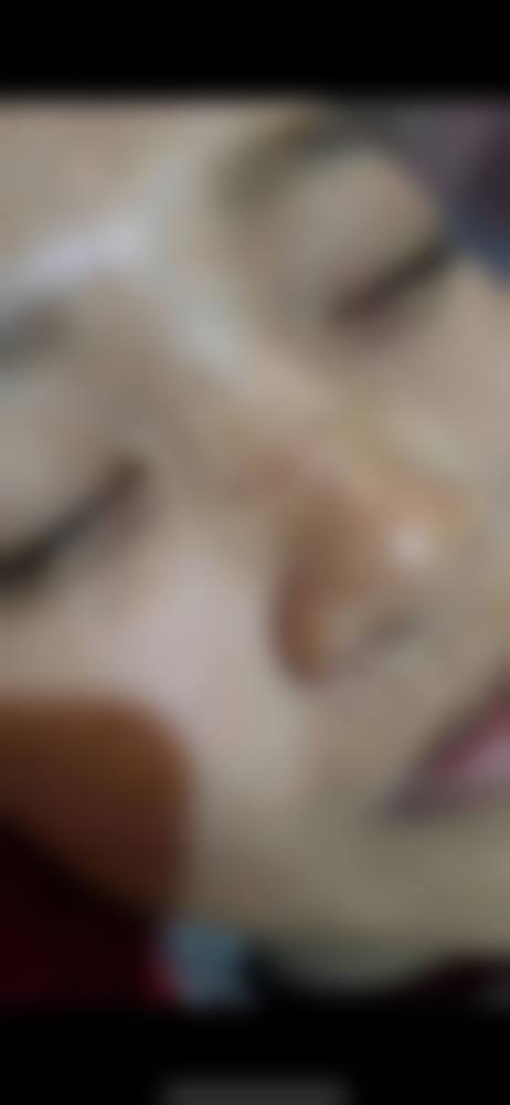 广州华美整形医院郝永生医生做手术价格