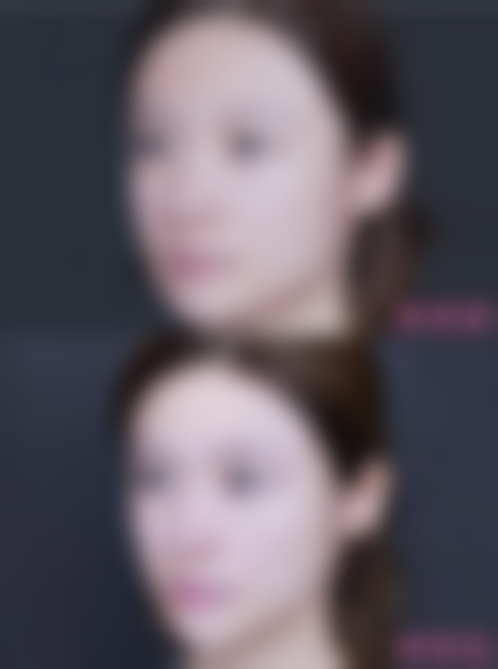 杭州美莱其他医美项目介绍