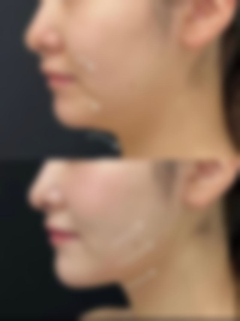 六、适合眼袋刮痧按摩的时间：把握黄金时段，成效翻倍